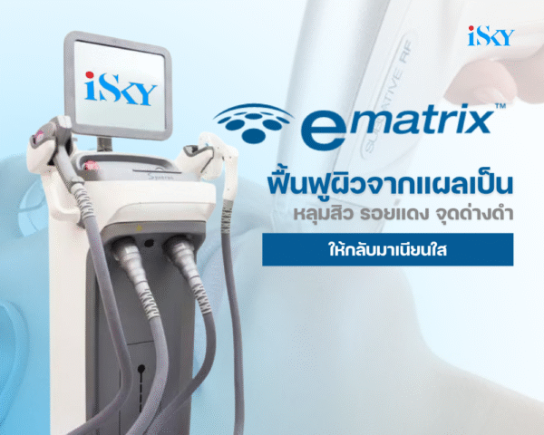 Program eMatrix ฟื้นฟูผิวจากหลุมสิว ให้กลับมาเนียนใส