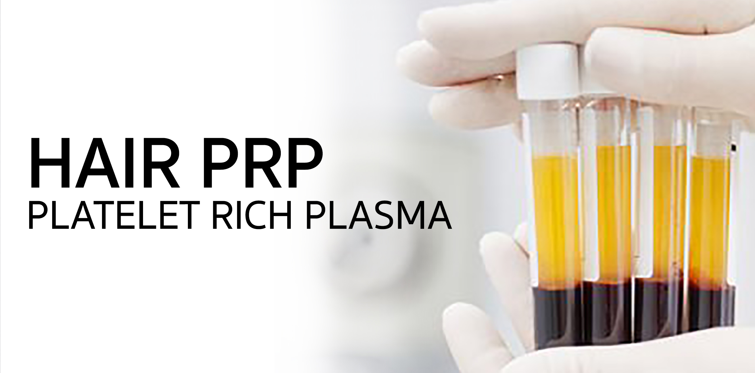 Hair Treatment: PRP (Platelet Rich Plasma)