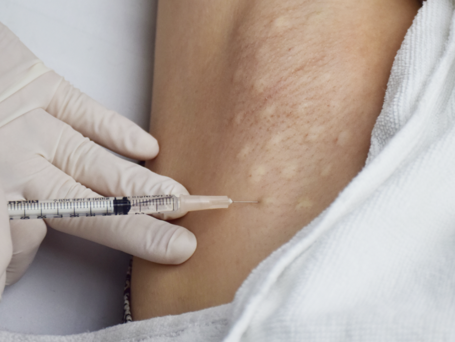 ลดเหงื่อ ลดกลิ่นตัว