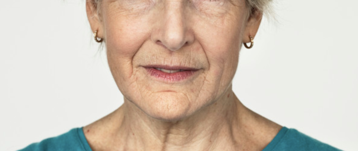 ริ้วรอยเหี่ยวย่น