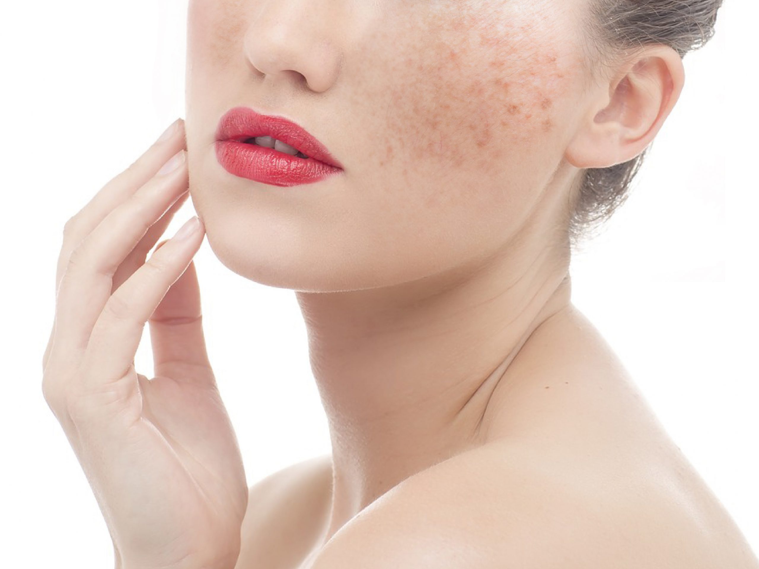 ฝ้ารักษาได้จริงเหรอ ?