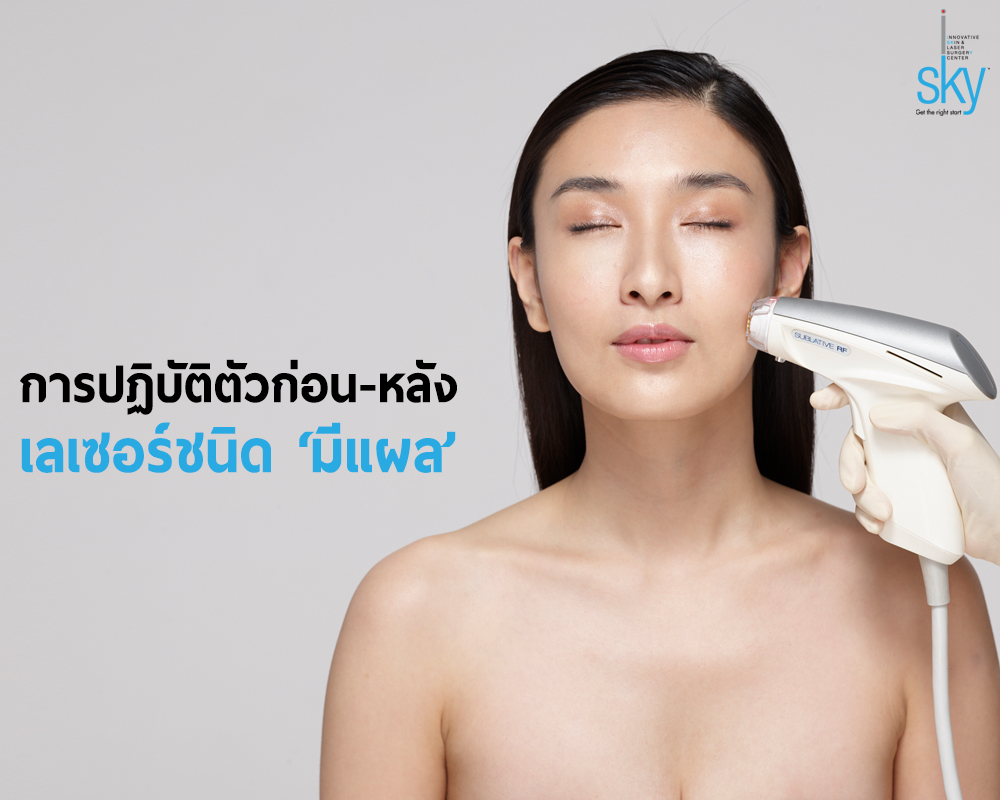 คำแนะนำในการปฏิบัติตัวก่อนและหลังการรักษาด้วยเลเซอร์ชนิด “มีแผล”