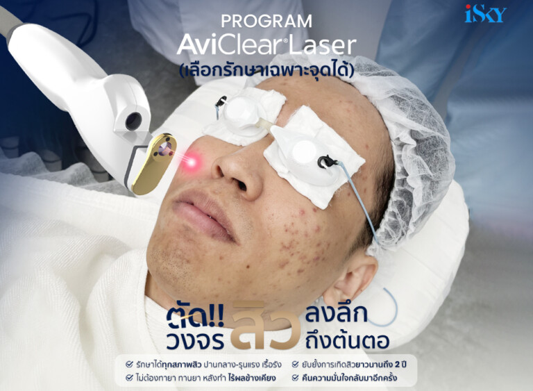 Program Lase Program AviClear Laser ตัด!! วงจรสิวลงลึกถึงต้นตอ | iSKY Center