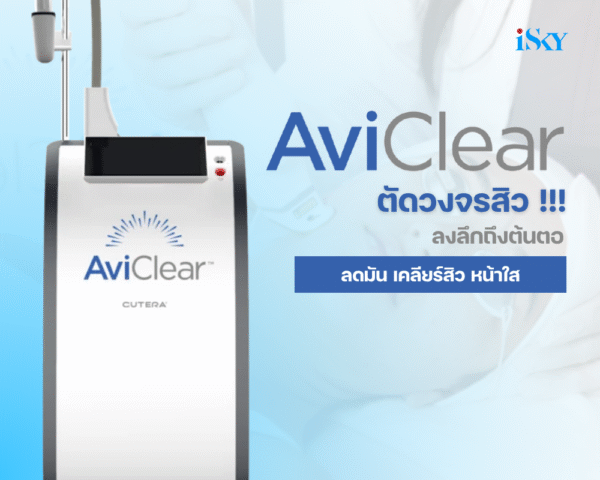 Program AviClear Laser ตัด!! วงจรสิวลงลึกถึงต้นตอ