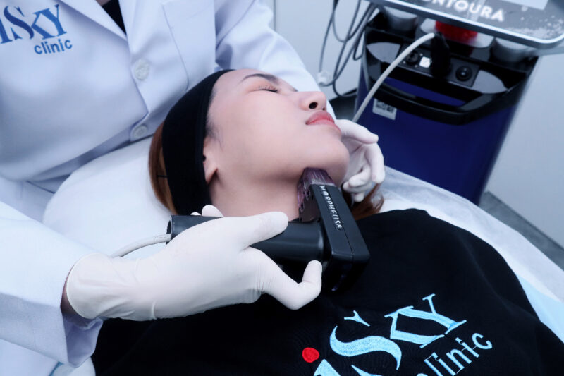 Program Morpheus8 กู้ผิวยับ กระชับผิวหย่อน ให้กลับมาเฟียซ