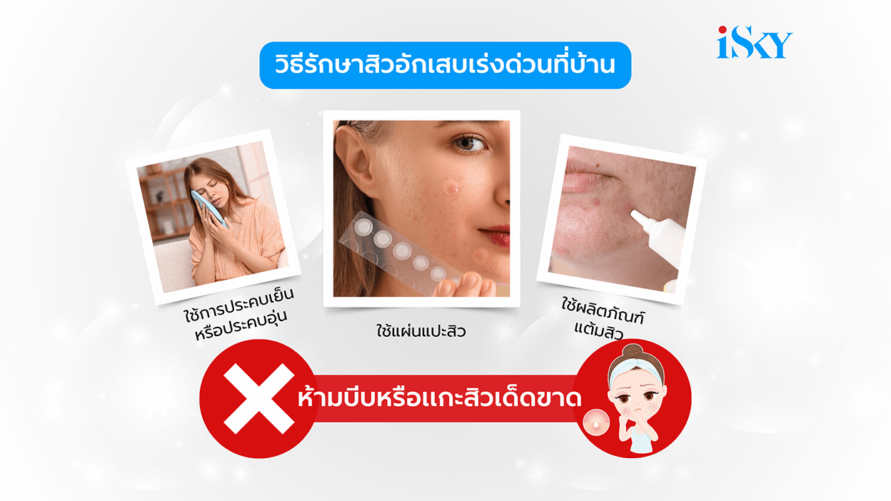 วิธีรักษาสิวอักเสบเร่งด่วนที่บ้าน